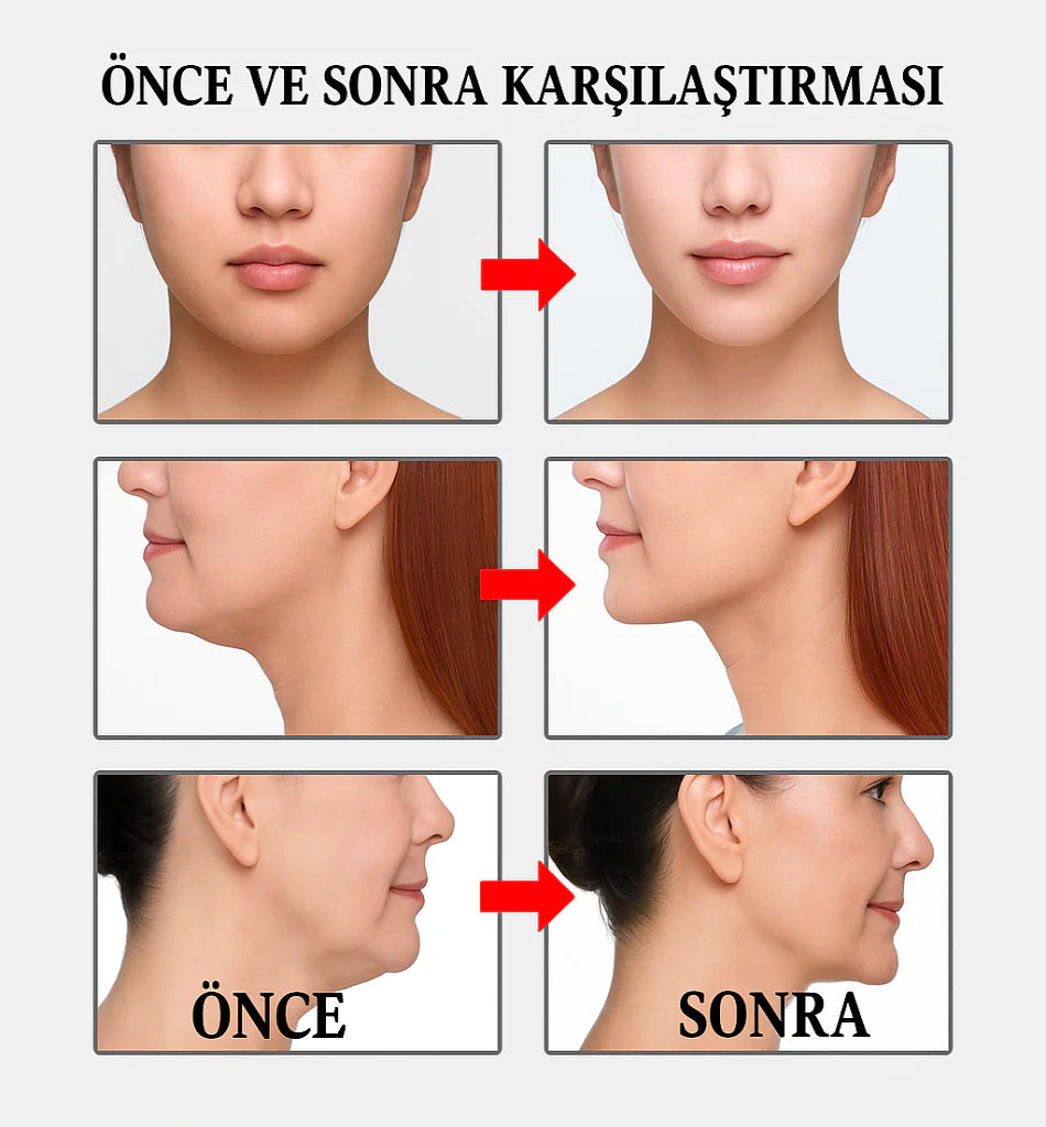 Yüz Lifting Bandı